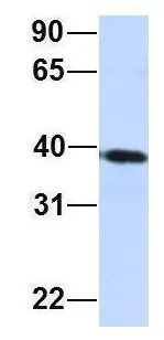 WB analysis of Jurkat cells using GTX46301 CARKD antibody at 1microg/ml.