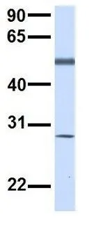 WB analysis of human placenta tissue using GTX46302 TMEM57 antibody at 1microg/ml.