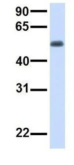 WB analysis of human fetal muscle tissue using GTX46302 TMEM57 antibody at 1microg/ml.