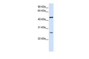 WB analysis of tranfected 293T cells using GTX46321 TMEM127 antibody at 0.2-1microg/ml. WB analysis of tranfected 293T cells using GTX46321 TMEM127 antibody at 0.2-1microg/ml.