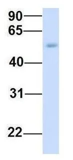 WB analysis of human fetal muscle tissue using GTX46324 TMEM161A antibody at 1microg/ml.