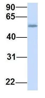 WB analysis of human fetal heart tissue using GTX46324 TMEM161A antibody at 1microg/ml.