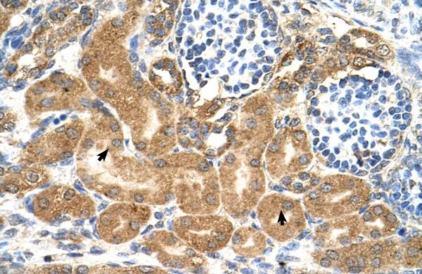 IHC-P analysis of human kidney tissue using GTX46338 TMEM69 antibody at 4.0-8.0microg/ml. IHC-P analysis of human kidney tissue using GTX46338 TMEM69 antibody at 4.0-8.0microg/ml.