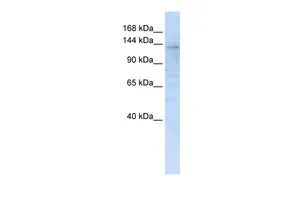 WB analysis of 293T cells using GTX46342 IMPG2 antibody at 0.2-1microg/ml. WB analysis of 293T cells using GTX46342 IMPG2 antibody at 0.2-1microg/ml.