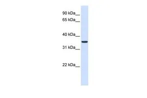 WB analysis of human fetal liver tissue using GTX46347 TXNDC14 antibody at 0.2-1microg/ml. WB analysis of human fetal liver tissue using GTX46347 TXNDC14 antibody at 0.2-1microg/ml.