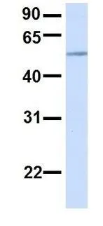 WB analysis of human placenta tissue using GTX46349 PIGT antibody at 1microg/ml.