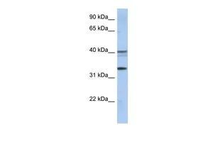 WB analysis of human placenta tissue using GTX46351 TEX264 antibody at 0.2-1microg/ml. WB analysis of human placenta tissue using GTX46351 TEX264 antibody at 0.2-1microg/ml.