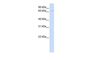 WB analysis of MCF-7 cells using GTX46358 UNC84B antibody at 0.2-1microg/ml. WB analysis of MCF-7 cells using GTX46358 UNC84B antibody at 0.2-1microg/ml.