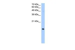 WB analysis of HepG2 cells using GTX46384 PILRA antibody at 0.2-1microg/ml. WB analysis of HepG2 cells using GTX46384 PILRA antibody at 0.2-1microg/ml.