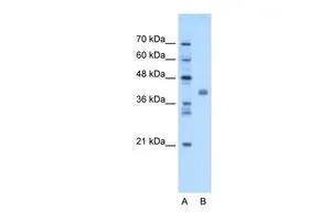 WB analysis of tranfected 293T cells using GTX46393 TMEM59L antibody at 1.25microg/ml. Lane A : marker Lane B : tranfected 293T cells WB analysis of tranfected 293T cells using GTX46393 TMEM59L antibody at 1.25microg/ml. Lane A : marker Lane B : tranfected 293T cells