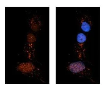 ICC/IF analysis of NT-2 cells using GTX46431 PDIA4 antibody at 1:500. Red : PDIA4 Blue : DAPI ICC/IF analysis of NT-2 cells using GTX46431 PDIA4 antibody at 1:500. Red : PDIA4 Blue : DAPI