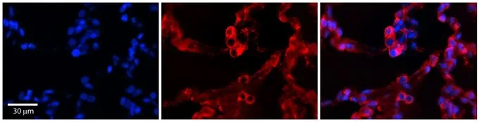 IHC-P analysis of human lung tissue using GTX46455 GPAA1 antibody at 1:600. Left to right:DAPI, GPAA1, Merge. Low pH, heat-induced antigen retrieval method utilizing Sodium Citrate buffer was performed.