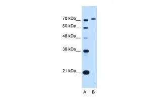 WB analysis of HepG2 cells using GTX46455 GPAA1 antibody at 0.2-1microg/ml. Lane A : marker Lane B : HepG2 cells
