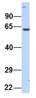 WB analysis of human placenta tissue using GTX46459 NT5DC2 antibody at 1microg/ml.