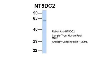 WB analysis of human fetal heart tissue using GTX46459 NT5DC2 antibody at 1microg/ml.