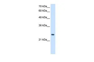 WB analysis of HepG2 cells using GTX46462 PPCDC antibody at 2.5microg/ml. WB analysis of HepG2 cells using GTX46462 PPCDC antibody at 2.5microg/ml.