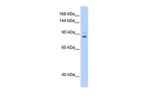 WB analysis of human B lymphoblast cells using GTX46477 TPX2 antibody at 0.2-1microg/ml. WB analysis of human B lymphoblast cells using GTX46477 TPX2 antibody at 0.2-1microg/ml.