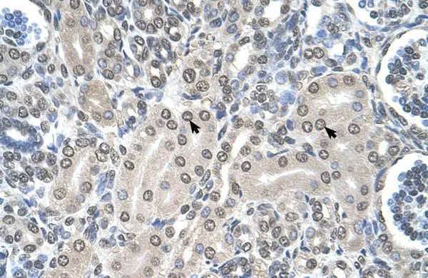 IHC-P analysis of human kidney tissue using GTX46481 SHMT2 antibody at 4.0-8.0microg/ml. IHC-P analysis of human kidney tissue using GTX46481 SHMT2 antibody at 4.0-8.0microg/ml.