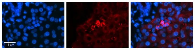 IHC-P analysis of human liver tissue using GTX46481 SHMT2 antibody at 1:600.