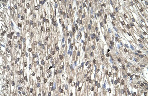 IHC-P analysis of human heart tissue using GTX46482 SHMT2 antibody at 4.0-8.0microg/ml. IHC-P analysis of human heart tissue using GTX46482 SHMT2 antibody at 4.0-8.0microg/ml.