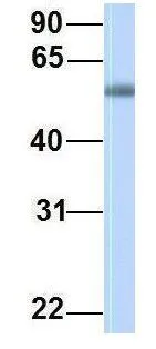 WB analysis of human fetal muscle tissue using GTX46491 PPAT antibody at 1microg/ml.