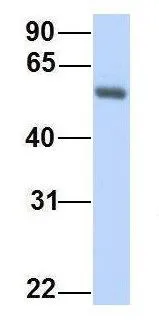 WB analysis of human fetal lung tissue using GTX46491 PPAT antibody at 1microg/ml.