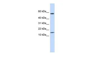 WB analysis of human placenta tissue using GTX46505 KRTAP11-1 antibody at 0.2-1microg/ml. WB analysis of human placenta tissue using GTX46505 KRTAP11-1 antibody at 0.2-1microg/ml.