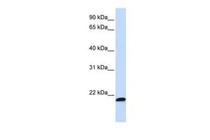 WB analysis of MCF-7 cells using GTX46513 C21ORF56 antibody at 0.2-1microg/ml. WB analysis of MCF-7 cells using GTX46513 C21ORF56 antibody at 0.2-1microg/ml.