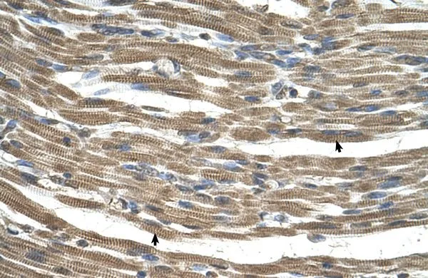 IHC-P analysis of human muscle tissue using GTX46523 C21ORF33 antibody at 4.0-8.0microg/ml. IHC-P analysis of human muscle tissue using GTX46523 C21ORF33 antibody at 4.0-8.0microg/ml.