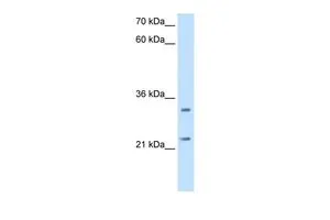 WB analysis of HepG2 cells using GTX46523 C21ORF33 antibody at 2.5microg/ml.