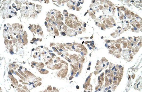 IHC-P analysis of human muscle tissue using GTX46546 CHST1 antibody at 4.0-8.0microg/ml. IHC-P analysis of human muscle tissue using GTX46546 CHST1 antibody at 4.0-8.0microg/ml.