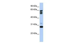 WB analysis of human B lymphoblast cells using GTX46549 TMEM187 antibody at 0.2-1microg/ml. WB analysis of human B lymphoblast cells using GTX46549 TMEM187 antibody at 0.2-1microg/ml.