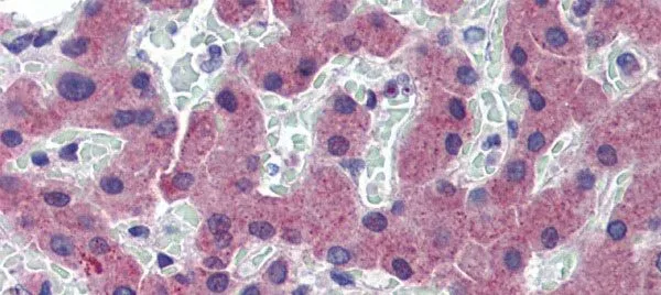 IHC-P analysis of human skin tissue using GTX46553 TFR2 antibody at 10.0microg/ml. IHC-P analysis of human skin tissue using GTX46553 TFR2 antibody at 10.0microg/ml.