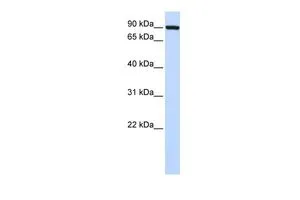 WB analysis of human fetal muscle tissue using GTX46553 TFR2 antibody at 0.2-1microg/ml.