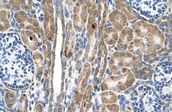 IHC-P analysis of human kidney tissue using GTX46583 FAM55D antibody at 4.0-8.0microg/ml. IHC-P analysis of human kidney tissue using GTX46583 FAM55D antibody at 4.0-8.0microg/ml.
