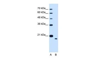 WB analysis of HepG2 cells using GTX46590 TMEM91 antibody at 1.25microg/ml. Lane A : marker Lane B : HepG2 cells WB analysis of HepG2 cells using GTX46590 TMEM91 antibody at 1.25microg/ml. Lane A : marker Lane B : HepG2 cells