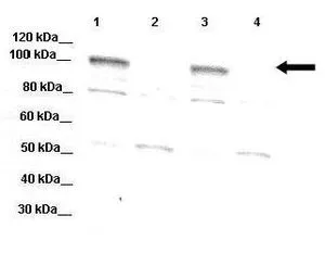 WB analysis of mouse brain (from WT mice and DPP6 knockout mice) tissue using GTX46610 DPP6 antibody at 1:1000. (Loading: 20microg) Lane 1: WT mouse brain extract Lane 2: DPP6 -/- mouse brain extract Lane 3: WT mouse brain extract Lane 4: DPP6 -/- mouse brain extract WB analysis of mouse brain (from WT mice and DPP6 knockout mice) tissue using GTX46610 DPP6 antibody at 1:1000. (Loading: 20microg) Lane 1: WT mouse brain extract Lane 2: DPP6 -/- mouse brain extract Lane 3: WT mouse brain extract Lane 4: DPP6 -/- mouse brain extract