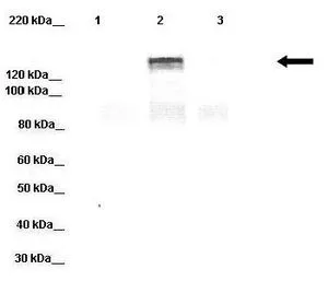 WB analysis of HEK293 cells over-expressing YFP tagged DPP6 protein using GTX46611 DPP6 antibody at 1:1000. Loading amount :20microg. Lane 1: HEK293 cell lysate Lane 2: HEK293 cells over-expressing hDPP6-YFP protein Lane 3: HEK293 cells over-expressing hDPP10-YFP protein