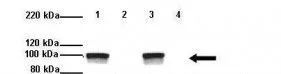 WB analysis of mouse brain (from WT mice and DPP6 knockout mice) tissue using GTX46611 DPP6 antibody at 1:1000. (Loading: 20microg) Lane 1: WT mouse brain extract Lane 2: DPP6 -/- mouse brain extract Lane 3: WT mouse brain extract Lane 4: DPP6 -/- mouse brain extract