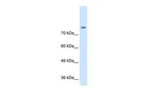 WB analysis of Jurkat cells using GTX46618 NRCAM antibody at 0.2-1microg/ml. WB analysis of Jurkat cells using GTX46618 NRCAM antibody at 0.2-1microg/ml.