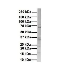 WB analysis of HEK293 cells using GTX46623 RHOT1 antibody at 1microg/ml.