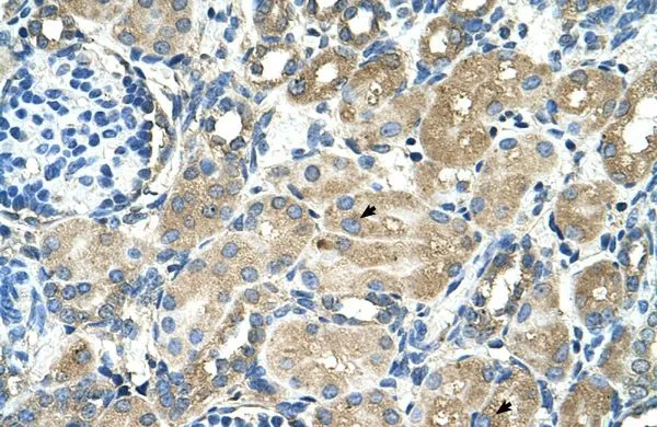 IHC-P analysis of human kidney tissue using GTX46657 TM9SF1 antibody at 4.0-8.0microg/ml. IHC-P analysis of human kidney tissue using GTX46657 TM9SF1 antibody at 4.0-8.0microg/ml.