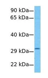 WB analysis of HeLa cells using GTX46672 AGPAT2 antibody at 1.0microg/ml.