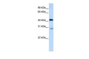WB analysis of human fetal lung tissue using GTX46673 GRAMD2 antibody at 0.2-1microg/ml. WB analysis of human fetal lung tissue using GTX46673 GRAMD2 antibody at 0.2-1microg/ml.