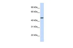 WB analysis of human fetal muscle tissue using GTX46675 GLT8D1 antibody at 0.2-1microg/ml. WB analysis of human fetal muscle tissue using GTX46675 GLT8D1 antibody at 0.2-1microg/ml.