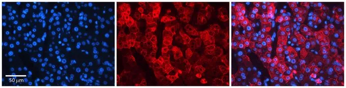 IHC-P analysis of human liver tissue using GTX46683 NIPA2 antibody at 1:100. Left to right: DAPI, NIPA2, Merge. Low pH, heat-induced antigen retrieval method utilizing Sodium Citrate buffer. IHC-P analysis of human liver tissue using GTX46683 NIPA2 antibody at 1:100. Left to right: DAPI, NIPA2, Merge. Low pH, heat-induced antigen retrieval method utilizing Sodium Citrate buffer.