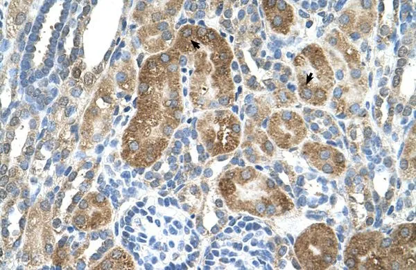 IHC-P analysis of human kidney tissue using GTX46721 C6ORF21 antibody at 4.0-8.0microg/ml. IHC-P analysis of human kidney tissue using GTX46721 C6ORF21 antibody at 4.0-8.0microg/ml.