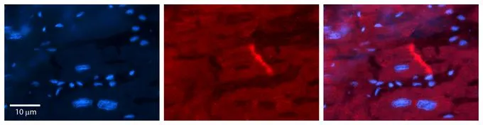 IHC-P analysis of human heart tissue using GTX46749 CYBA antibody at 1:100. Left to right:DAPI, CYBA, Merge. Heat induced antigen retrieval method using Antigen retrieval buffer (Tris EDTA, pH 9.0) for 2-3 minutes in pressure cooker. IHC-P analysis of human heart tissue using GTX46749 CYBA antibody at 1:100. Left to right:DAPI, CYBA, Merge. Heat induced antigen retrieval method using Antigen retrieval buffer (Tris EDTA, pH 9.0) for 2-3 minutes in pressure cooker.