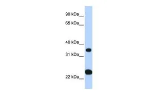 WB analysis of human fetal liver tissue using GTX46752 SLC25A35 antibody at 0.2-1microg/ml. WB analysis of human fetal liver tissue using GTX46752 SLC25A35 antibody at 0.2-1microg/ml.