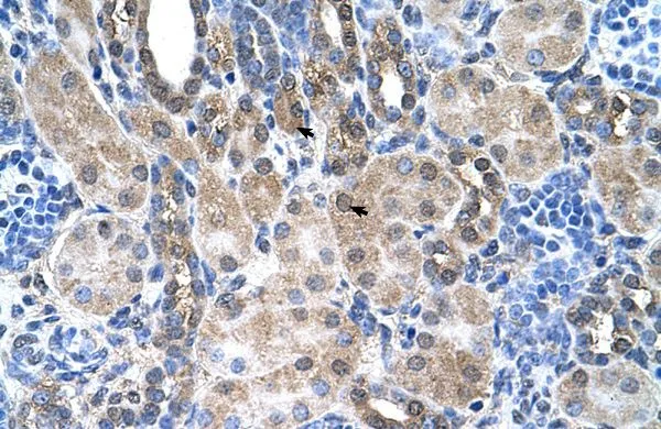 IHC-P analysis of human kidney tissue using GTX46755 SLC6A18 antibody at 4.0-8.0microg/ml. IHC-P analysis of human kidney tissue using GTX46755 SLC6A18 antibody at 4.0-8.0microg/ml.